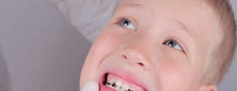 Preventing crooked teeth in children – expert tips