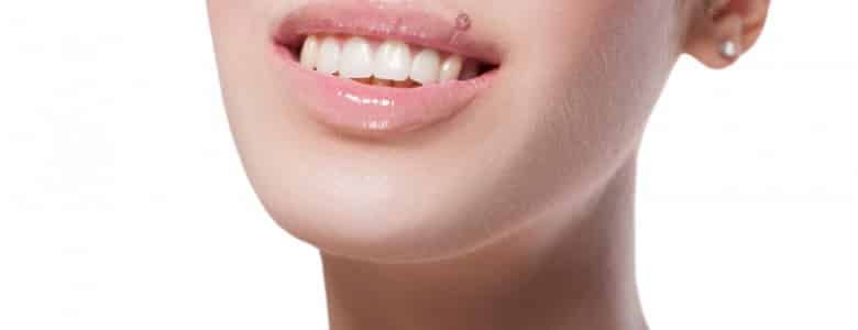 How To Correct Teeth Alignment